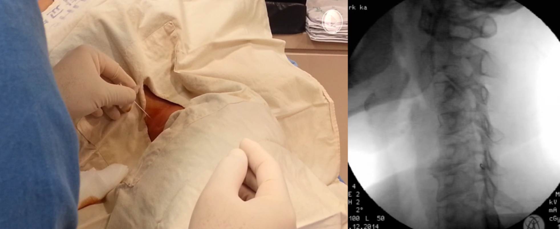 Pasted image 20240719101105.png